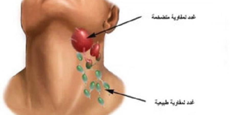 حسام موافي: الغدد اللمفاوية خط الدفاع الأول ضد الأمراض والالتهابات