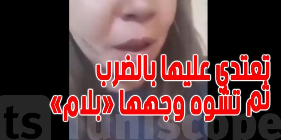 عاجل - المنيهلة : فتاة تتعرض للضرب ثم التشويه ''بالة حادة'' من قبل جارة و ابنتها ....